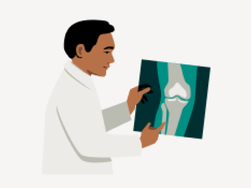 illustration of a doctor holding an x-ray image